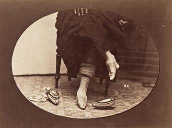 WILLIAM SAUNDERS (1832-1892) A pair of photographs, both depicting Chinese womens' bound feet.